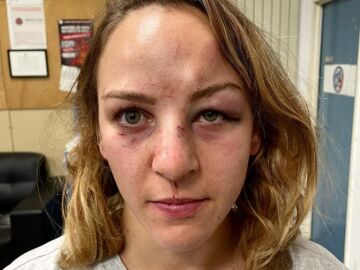 Margaux Pinot, campeona olímpica de judo, denuncia la agresión de su novio y entrenador: "¿Qué ha faltado, la muerte?"