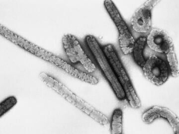 Imagen del virus de Marburgo ampliado