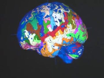 El cerebelo, al descubierto gracias a un sistema informático pionero